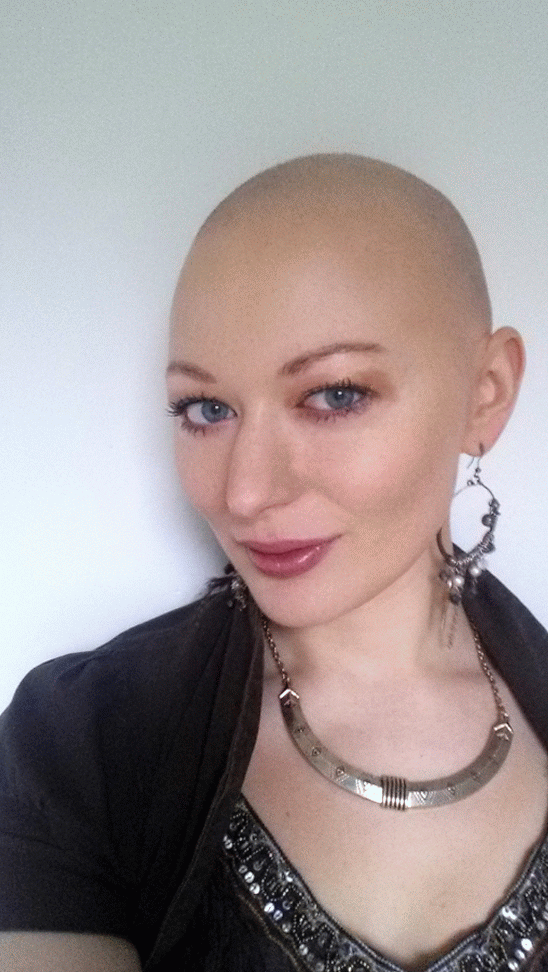 20150216_084637-MOTION